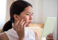 5 skin conditions that dermatologists can treat virtually